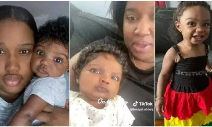 "She is not a doll; she's my baby" - Mother of unique-looking child addresses ill-comments