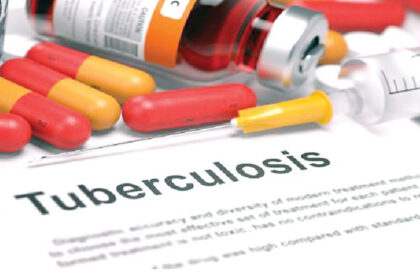 TUBERCULOSIS