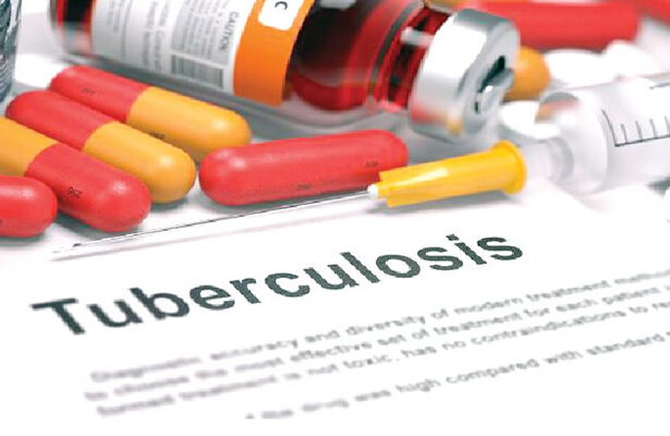 TUBERCULOSIS