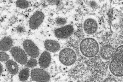 Electron microscope image of various virions (virus particles) of a monkeypox virus taken from human skin.Smith Collection/Gado/Getty Images