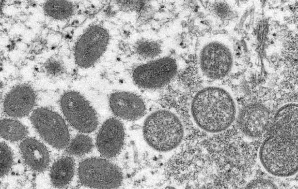 Electron microscope image of various virions (virus particles) of a monkeypox virus taken from human skin.Smith Collection/Gado/Getty Images